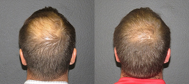 Hair Before & After