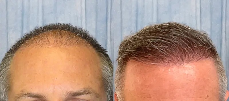 Hair Before & After