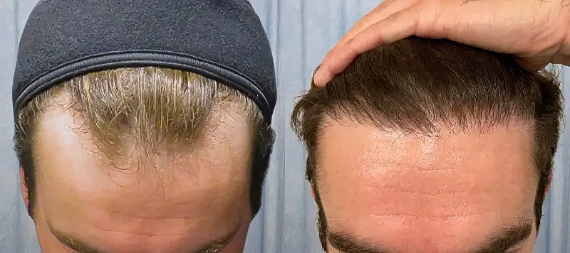 Hair Before & After